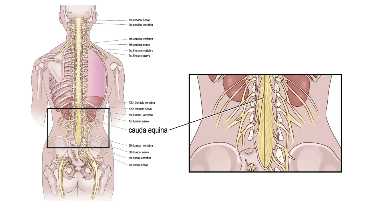 Illustrazione anatomica della colonna vertebrale e dei nervi. Evidenziata la cauda equina, importante per i cauda equina sintomi iniziali.