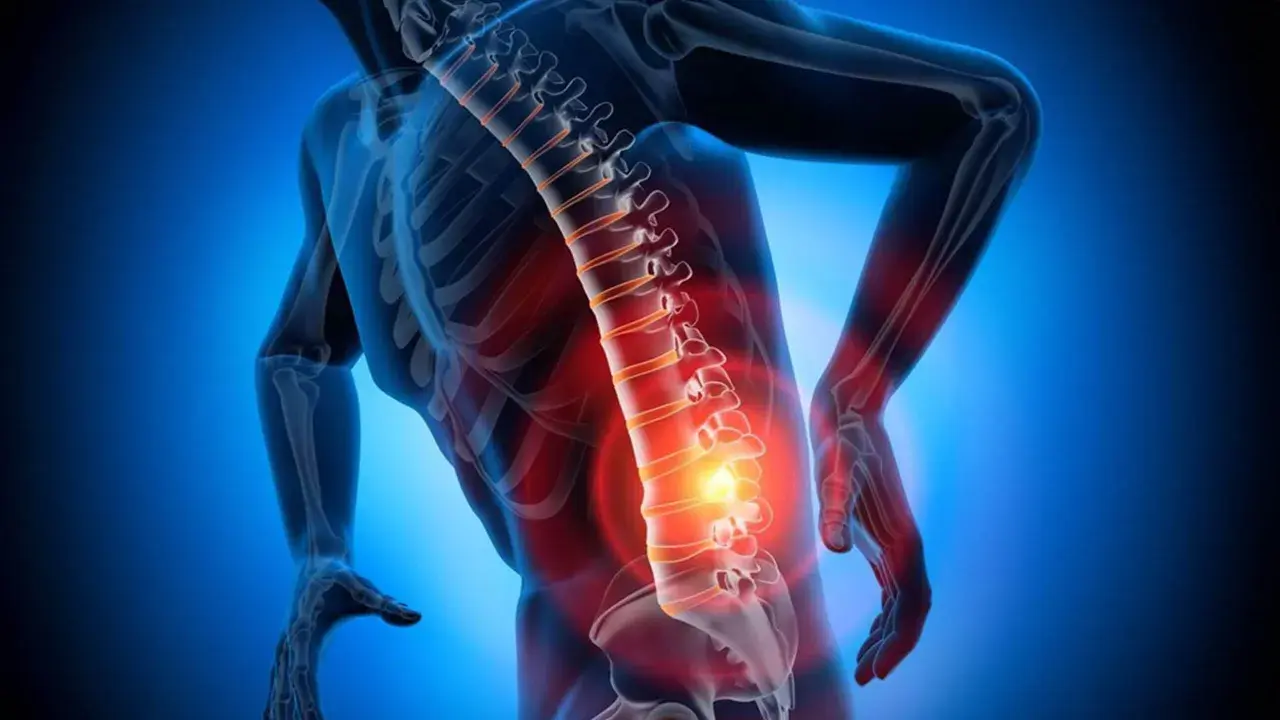 Schiena umana con colonna vertebrale evidenziata in rosso, indicando dolore e possibili ernia lombare con sintomi neurologici.