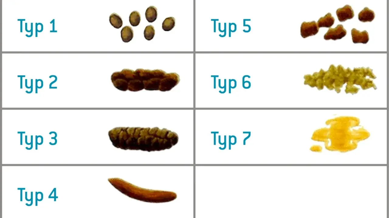 Tipi di feci da dure a liquide. Per capire come indurire le feci, osserva i tipi 1-4, che indicano feci più solide.