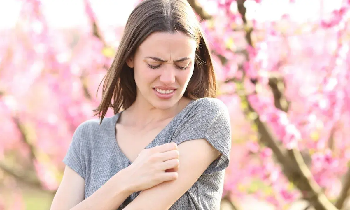 Donna con prurito in tutto il corpo la sera, graffiandosi il braccio tra i fiori rosa.