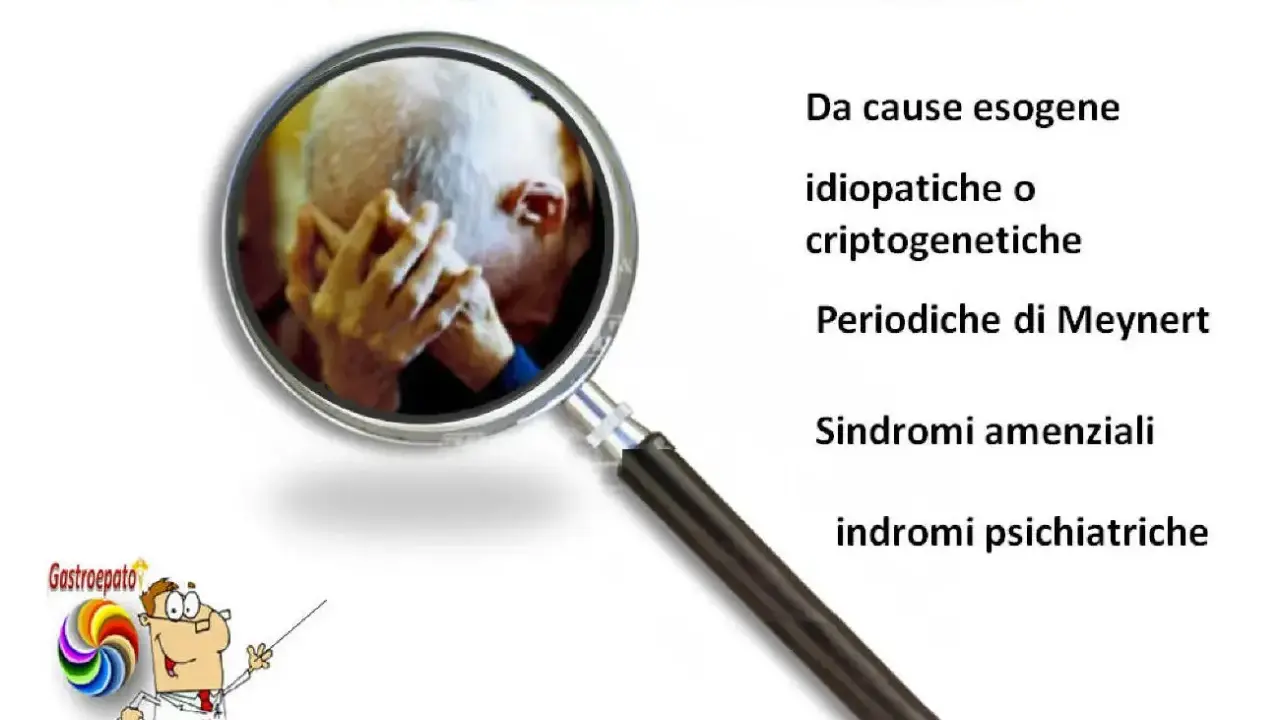 Ingrandimento su un anziano con mani sul volto, simbolo di confusione mentale. Elenco di cause: esogene, idiopatiche, criptogenetiche, Meynert, amenziali, psichiatriche.