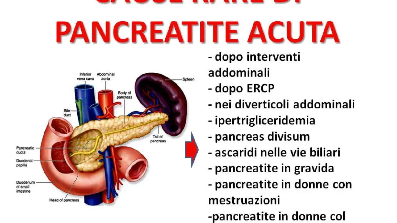 Anatomia del pancreas e cause rare di pancreatite acuta: interventi addominali, ipertrigliceridemia, pancreatite in gravidanza e donne.