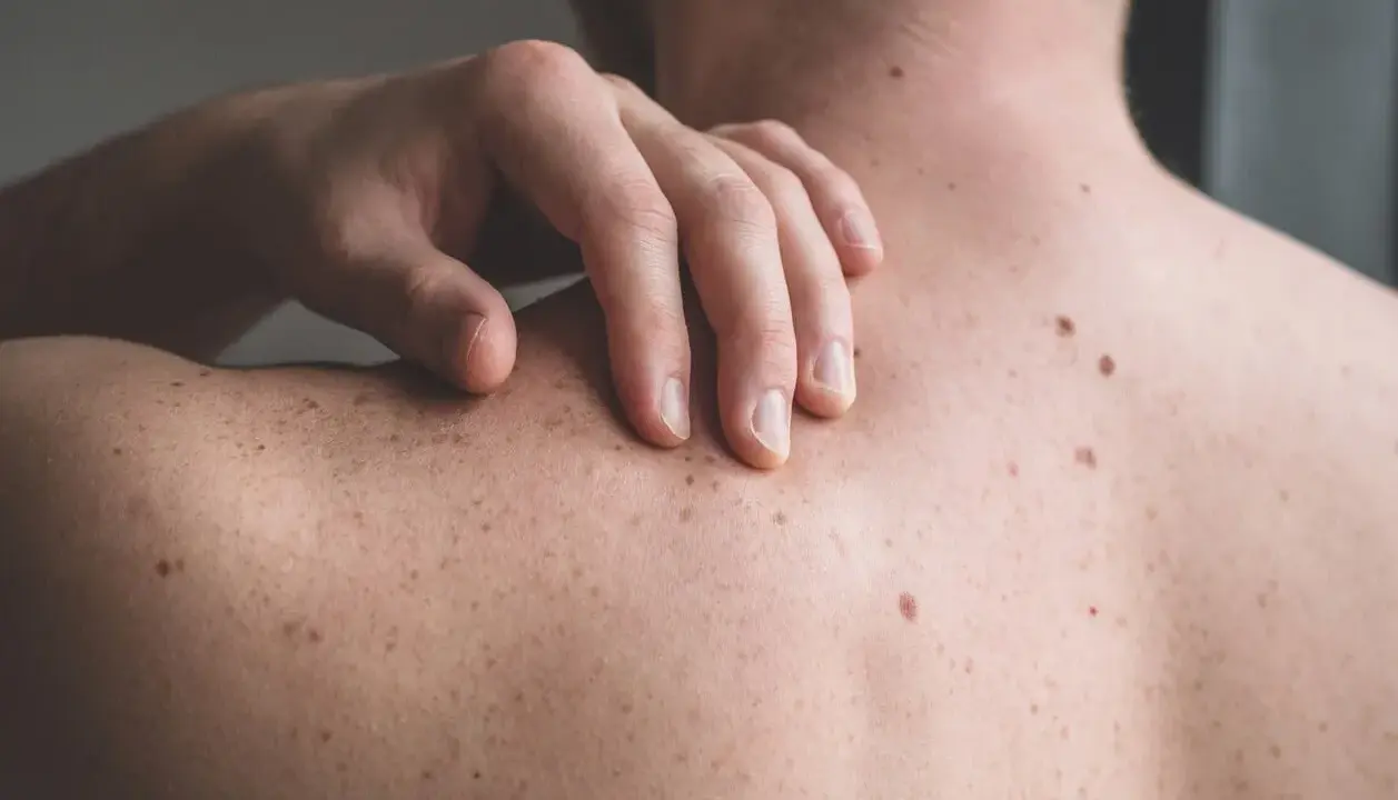 Una mano sfiora la schiena coperta di nei. Un neo irritato, forse dopo che ho grattato un neo ed è uscito sangue, attira l'attenzione.