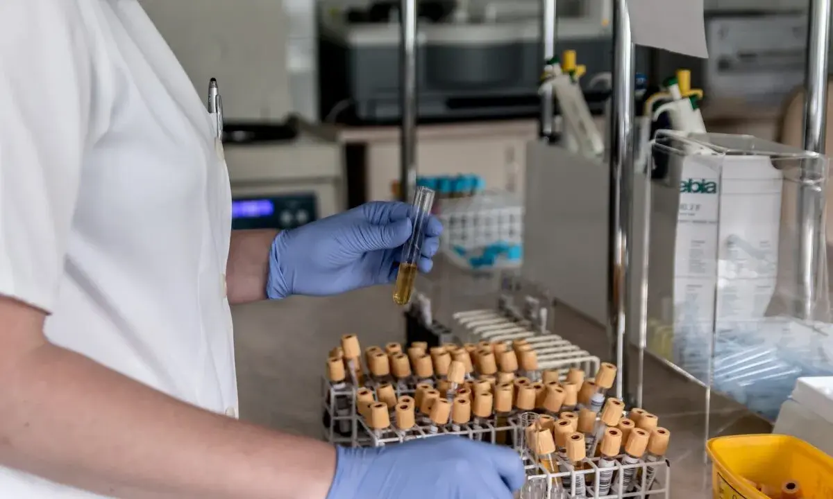 Analisi in laboratorio per capire come abbassare le transaminasi velocemente. Esami del sangue in provette.