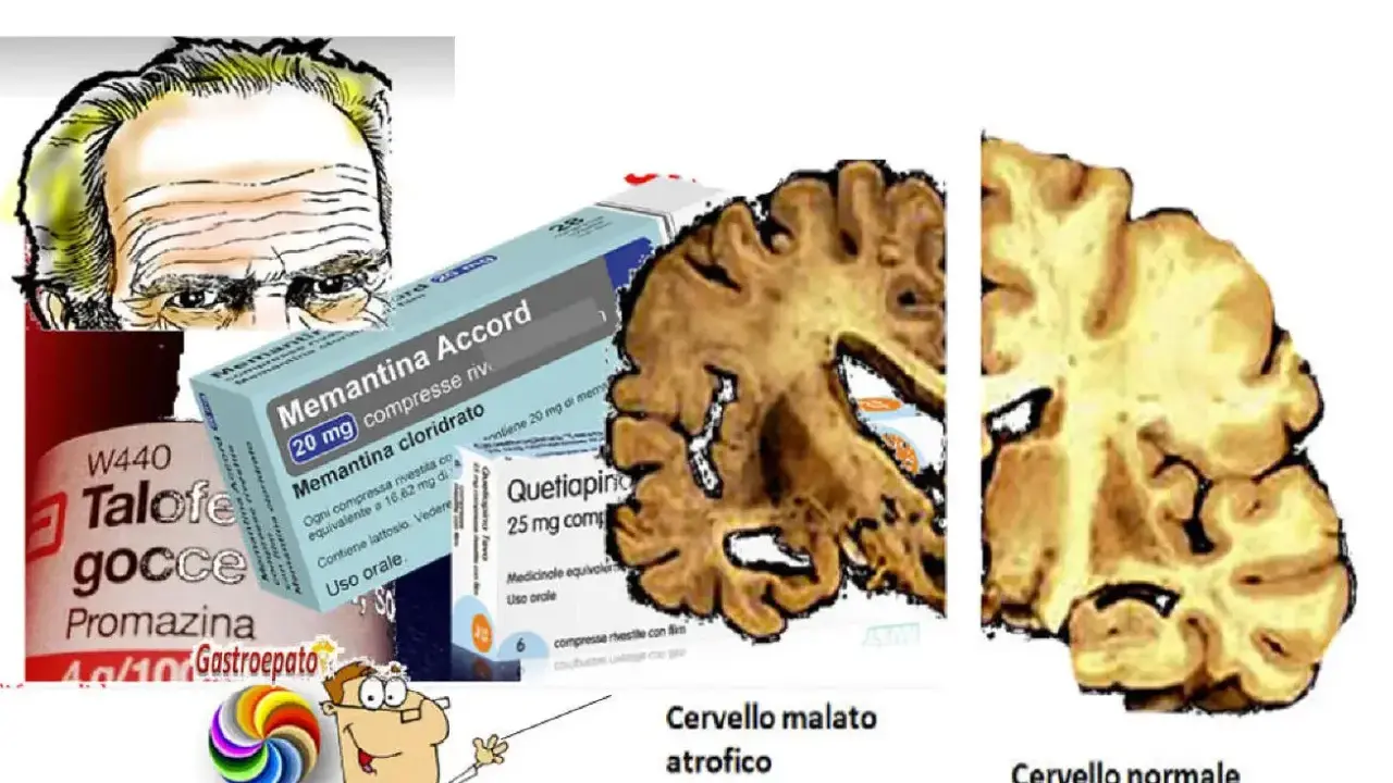 Illustrazione di un cervello atrofico e uno normale, farmaci e un medico che indica il decadimento cognitivo lieve.