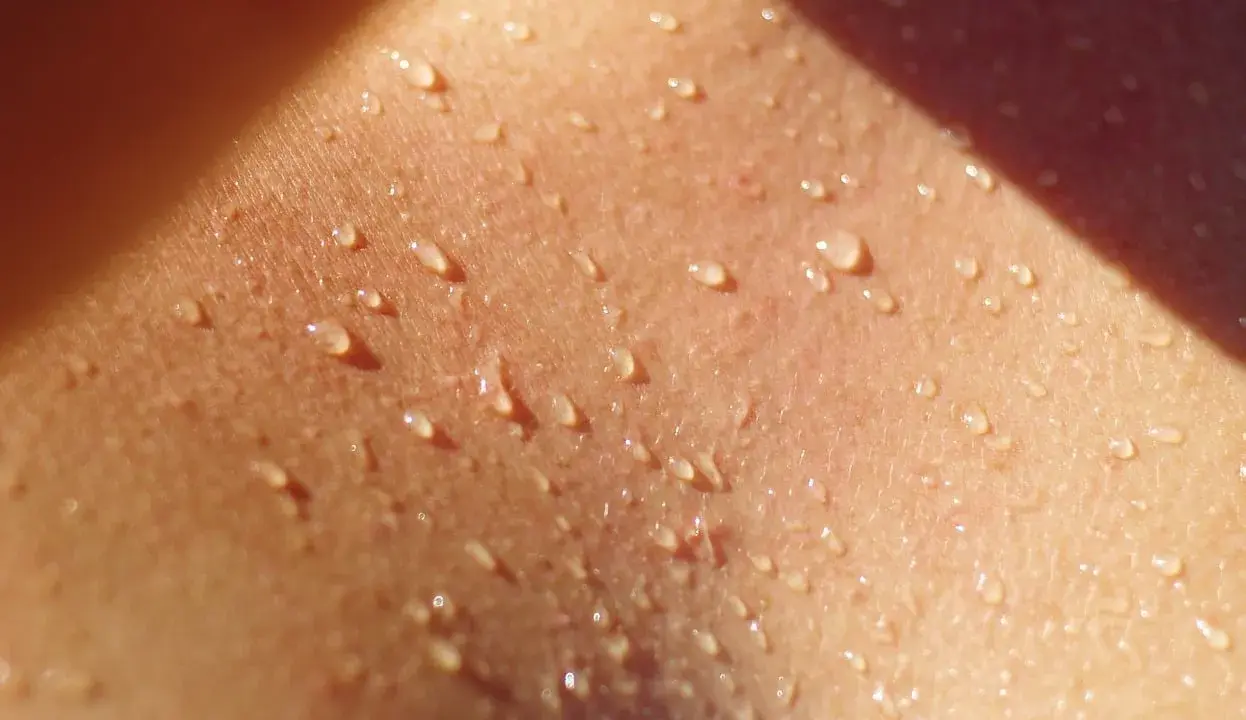 Goccioline di sudore brillano sulla pelle, un segno di calore e attività. Potrebbe essere l'inizio di un eritema da sudore.