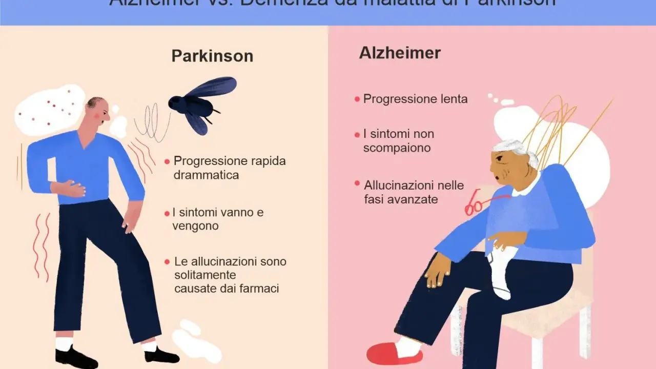 Confronto tra Parkinson e Alzheimer: progressione, sintomi e allucinazioni. Differenza tra parkinson e alzheimer illustrata con icone.