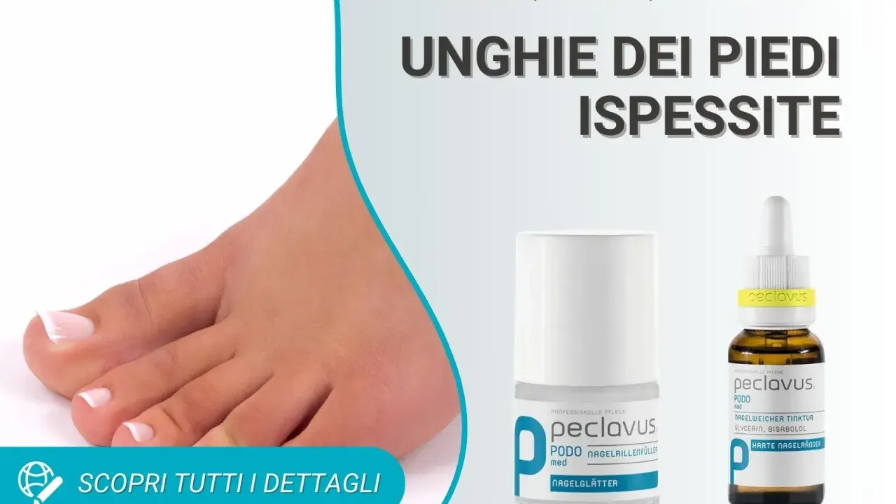 Piedi con unghie ispessite. Soluzioni e rimedi per la cura delle unghie dei piedi.