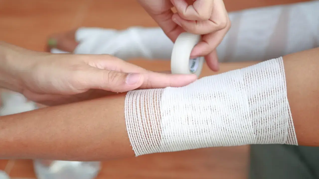 Applicazione di una fasciatura su un braccio, seguendo la regola del 9 ustioni per valutare l'estensione.