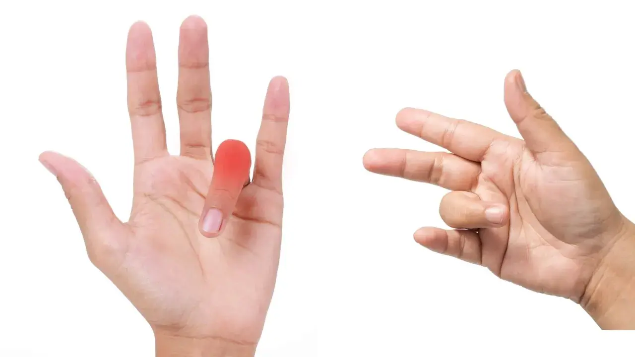 Mano con dito arrossato e un'altra mano che mostra movimenti per esercizi utili per dito a scatto.