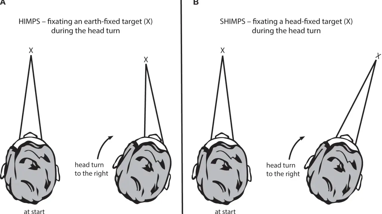 Il test **head impulse test** confronta la fissazione di un bersaglio fisso (A) con quella di un bersaglio mobile con la testa (B) durante una rotazione.