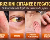 Eruzioni cutanee, ittero e prurito persistente alla pancia sono sintomi legati a malattie del fegato.
