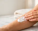 Mano che applica crema su un braccio, un rimedio per il prurito psicosomatico.