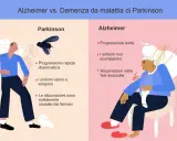 Confronto tra Parkinson e Alzheimer: progressione, sintomi e allucinazioni. Differenza tra parkinson e alzheimer illustrata con icone.