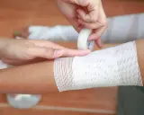 Applicazione di una fasciatura su un braccio, seguendo la regola del 9 ustioni per valutare l'estensione.