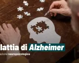 Mani anziane compongono un puzzle a forma di testa, simboleggiando la progressione della malattia di Alzheimer in quanto tempo degenera.