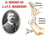 Ritratto di J.J.F. Babinski, con illustrazioni del riflesso normale e del riflesso di Babinski positivo.