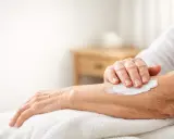 Mano anziana applica crema idratante su un braccio per alleviare i pruriti sul corpo.