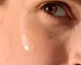 Goccia di siero su pelle con macchie bianche e lentiggini.