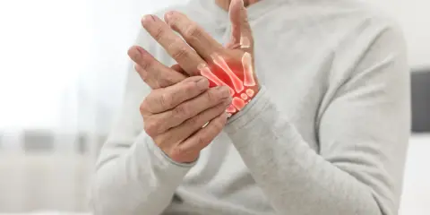 Uomo anziano con mani che mostrano i sintomi dell'osteoartrosi, con ossa evidenziate in rosso per indicare infiammazione.
