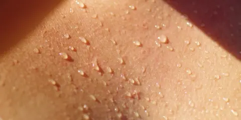 Goccioline di sudore brillano sulla pelle, un segno di calore e attività. Potrebbe essere l'inizio di un eritema da sudore.