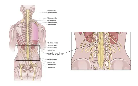 Illustrazione anatomica della colonna vertebrale e dei nervi. Evidenziata la cauda equina, importante per i cauda equina sintomi iniziali.