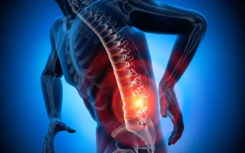 Schiena umana con colonna vertebrale evidenziata in rosso, indicando dolore e possibili ernia lombare con sintomi neurologici.