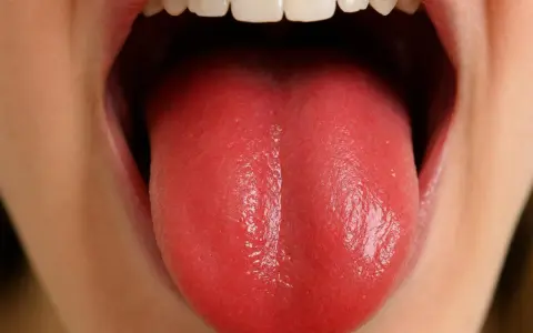 Lingua rossa lucida, un segno che potrebbe indicare cambiamenti nella salute, anche negli anziani.