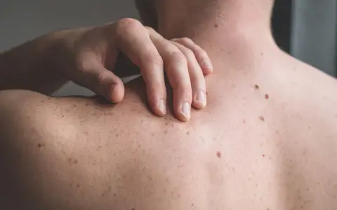 Una mano sfiora la schiena coperta di nei. Un neo irritato, forse dopo che ho grattato un neo ed è uscito sangue, attira l'attenzione.