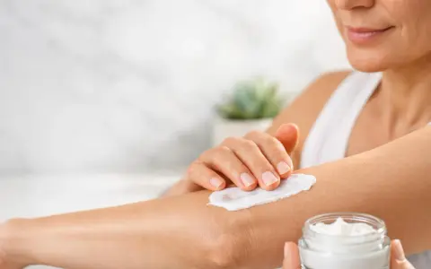 Donna applica crema idratante sul braccio per alleviare il prurito sine materia.