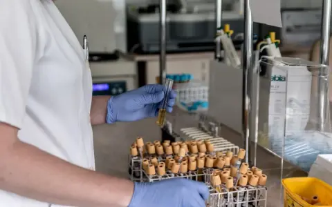 Analisi in laboratorio per capire come abbassare le transaminasi velocemente. Esami del sangue in provette.
