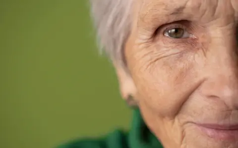 Primo piano di un occhio e parte del viso di un'anziana. Potrebbe rappresentare la ricerca di gocce calmanti per demenza senile.