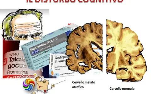 Illustrazione di un cervello atrofico e uno normale, farmaci e un medico che indica il decadimento cognitivo lieve.