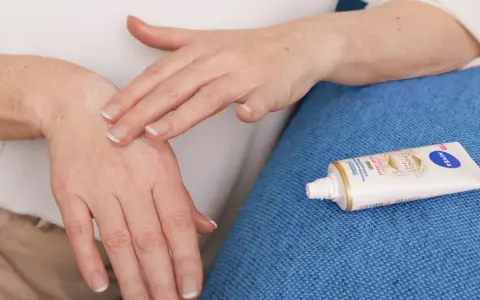 Mani che si massaggiano crema idratante per alleviare il prurito alle mani. Tubetto di Nivea Luminous 630 in primo piano.