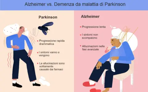 Confronto tra Parkinson e Alzheimer: progressione, sintomi e allucinazioni. Differenza tra parkinson e alzheimer illustrata con icone.