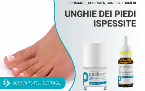Piedi con unghie ispessite. Soluzioni e rimedi per la cura delle unghie dei piedi.