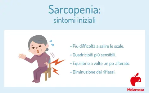 Anziana con difficoltà a sedersi, sintomi iniziali di sarcopenia: fatica a salire le scale, quadricipiti sensibili, equilibrio alterato, riflessi diminuiti.