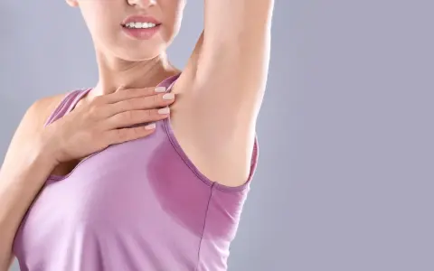 Donna con ascella bagnata, un segno di sudorazione eccessiva. Le cause possono essere molteplici, dallo stress al caldo.