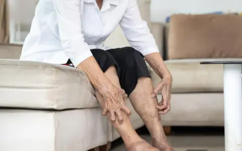Gambe anziani con pelle secca e macchie, che indicano il passare del tempo e la necessità di cure.