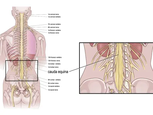 Illustrazione anatomica della colonna vertebrale e dei nervi. Evidenziata la cauda equina, importante per i cauda equina sintomi iniziali.