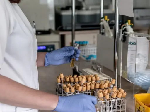 Analisi in laboratorio per capire come abbassare le transaminasi velocemente. Esami del sangue in provette.