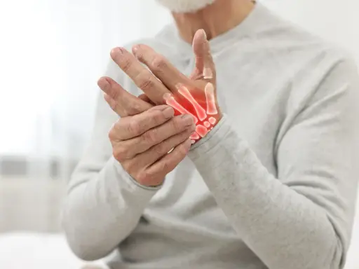 Uomo anziano con mani che mostrano i sintomi dell'osteoartrosi, con ossa evidenziate in rosso per indicare infiammazione.