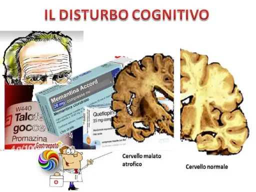 Illustrazione di un cervello atrofico e uno normale, farmaci e un medico che indica il decadimento cognitivo lieve.