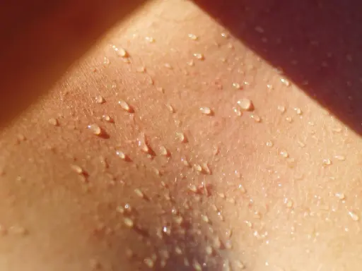 Goccioline di sudore brillano sulla pelle, un segno di calore e attività. Potrebbe essere l'inizio di un eritema da sudore.