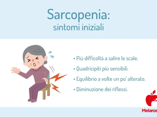 Anziana con difficoltà a sedersi, sintomi iniziali di sarcopenia: fatica a salire le scale, quadricipiti sensibili, equilibrio alterato, riflessi diminuiti.