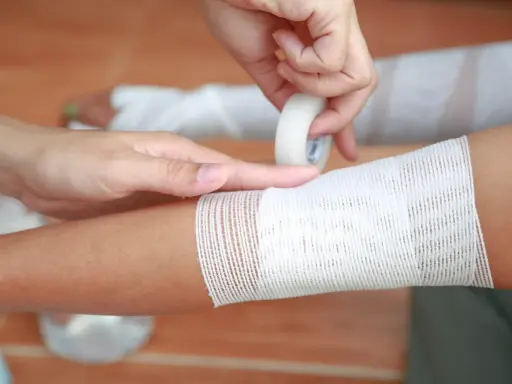 Applicazione di una fasciatura su un braccio, seguendo la regola del 9 ustioni per valutare l'estensione.