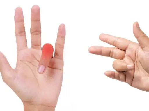 Mano con dito arrossato e un'altra mano che mostra movimenti per esercizi utili per dito a scatto.