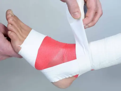 Applicazione di bendaggio ossido di zinco sulla caviglia per supporto e protezione.