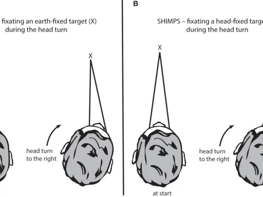 Il test **head impulse test** confronta la fissazione di un bersaglio fisso (A) con quella di un bersaglio mobile con la testa (B) durante una rotazione.