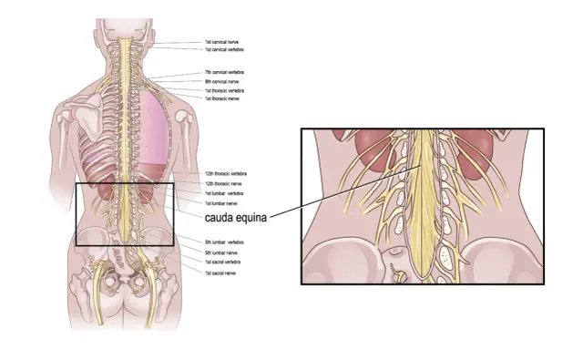 Illustrazione anatomica della colonna vertebrale e dei nervi. Evidenziata la cauda equina, importante per i cauda equina sintomi iniziali.